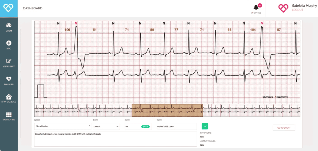 Monitoring Software — reviewing a rhythm strip with beat annotations